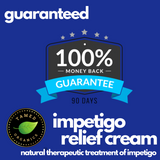 Impetigo Natural Relief Cream | 2 Pack