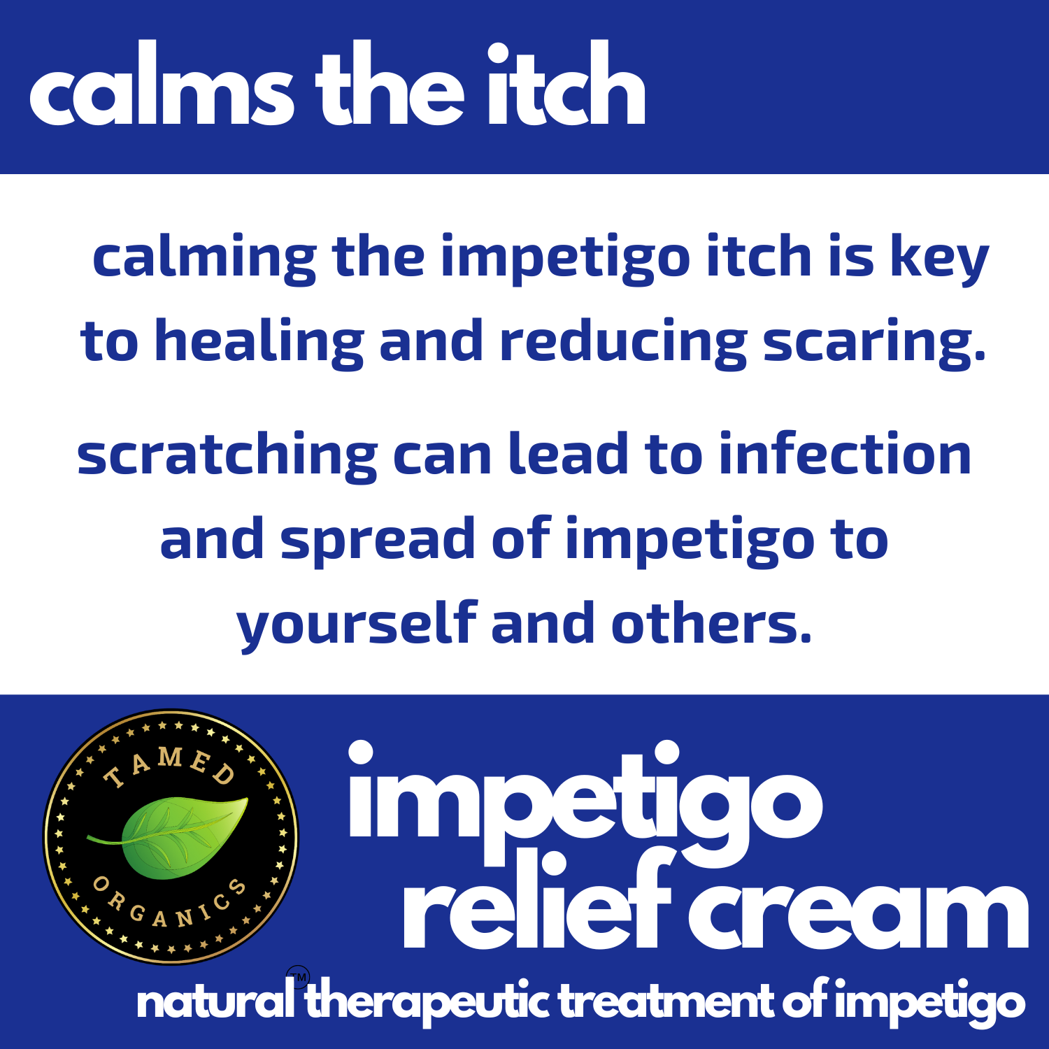 Impetigo Natural Relief Cream | 3 Pack