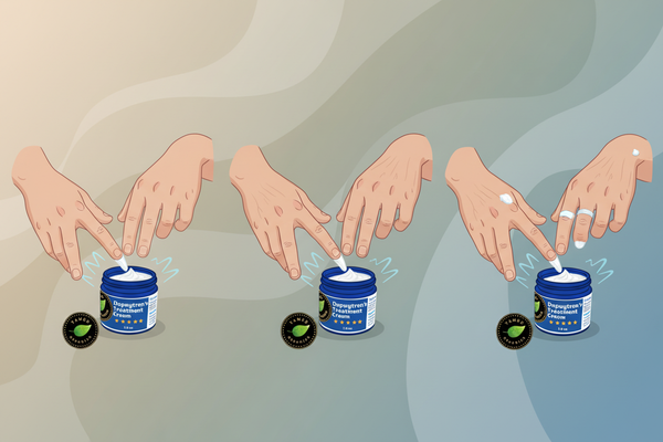 Does Dupuytren's Contracture Get Worse with Age?