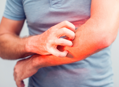 Can You Get Rid of Scabies in 24 Hours?