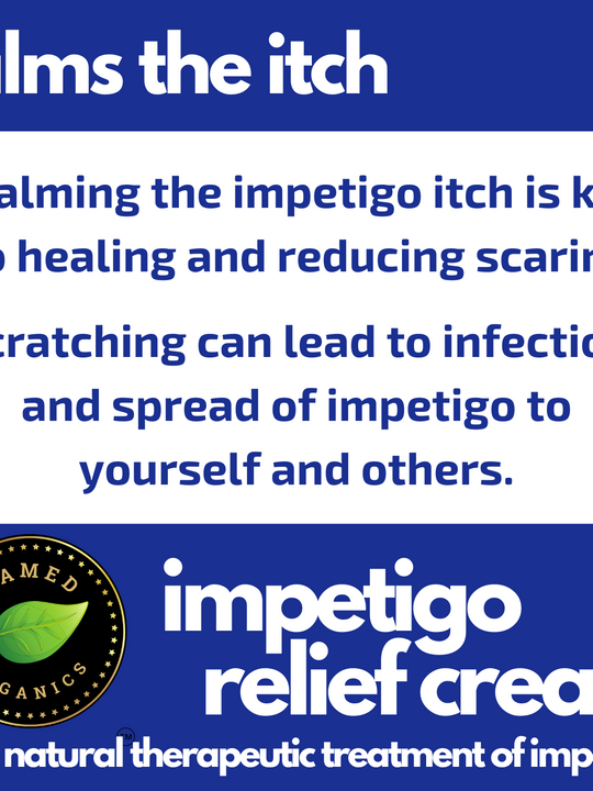 Impetigo Natural Relief Cream | 2 Pack