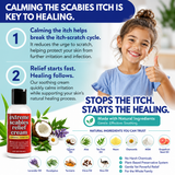 Extreme Scabies Relief Cream infographic showing how calming scabies itch helps support healing and reduce scratching. Features natural ingredients including tea tree oil, neem, sulfur, aloe, chamomile, MSM, lavender oil, eucalyptus, turmeric, clove oil, emu oil, and grapefruit seed oil for soothing scabies symptoms and skin irritation.