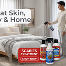 Man spraying mattress with mite treatment spray alongside scabies treatment cream, body wash and shampoo for full home and skin care