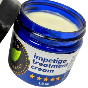 Impetigo Natural Relief Cream