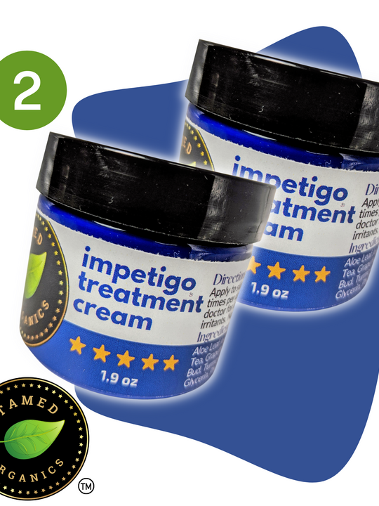 Impetigo Natural Relief Cream | 2 Pack