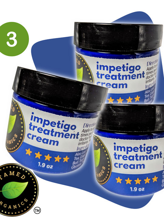 Impetigo Natural Relief Cream | 3 Pack