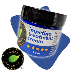 Impetigo Natural Relief Cream