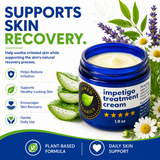 Impetigo Treatment Cream with aloe vera, chamomile, and botanical ingredients to support skin recovery and soothe irritated skin.