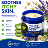 Impetigo Treatment Cream with aloe vera, chamomile, and lavender to help soothe itchy skin, reduce discomfort, and support healthier-looking skin.