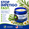 Impetigo Natural Relief Cream