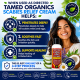 Extreme Scabies Relief Cream helps target scabies mites and eggs, relieve itching and irritation, and support healing as part of a complete scabies treatment kit."