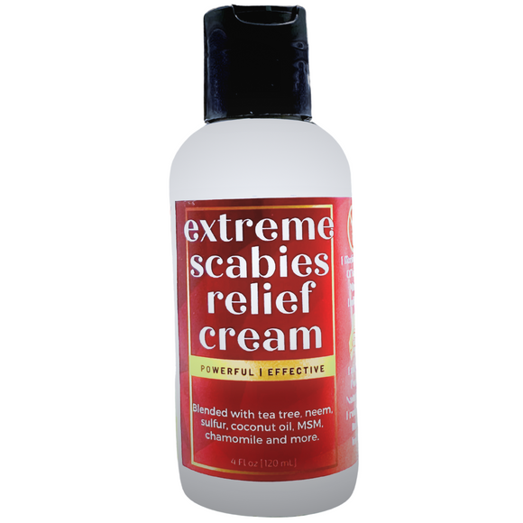 Extreme Scabies Relief Cream (4 Fl Oz)