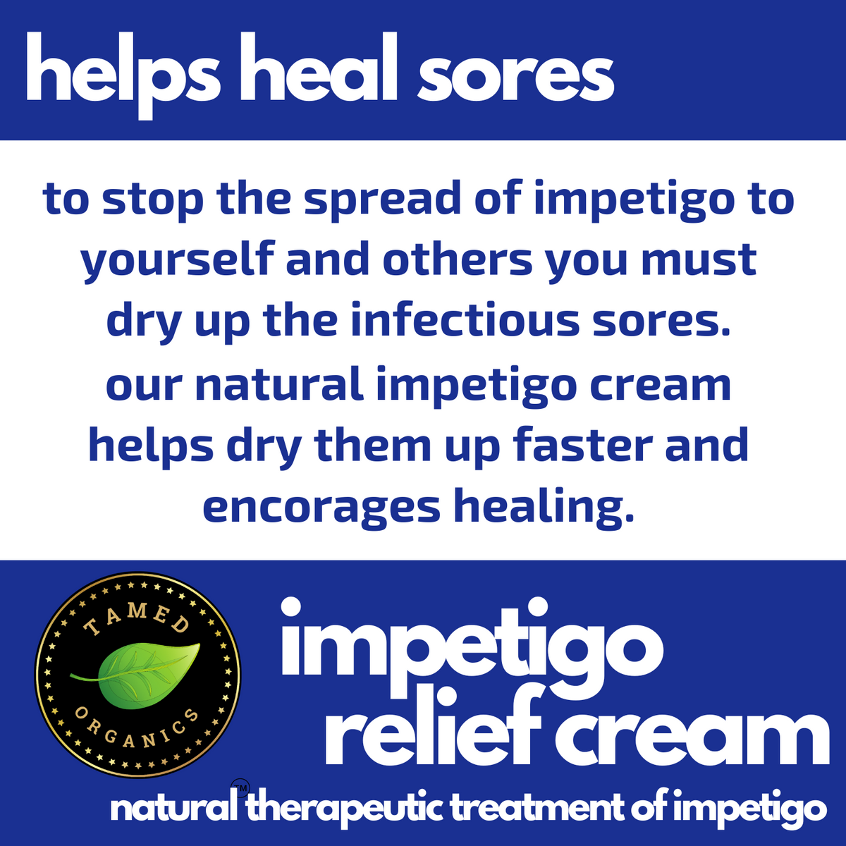 Impetigo Natural Relief Cream Tamed Organics Natural Solutions